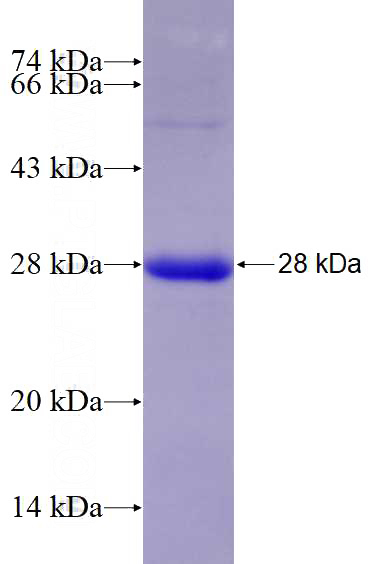 Recombinant Mouse H2-K1 SDS-PAGE