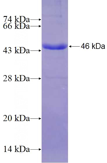 Recombinant Human ALDH5A1 SDS-PAGE