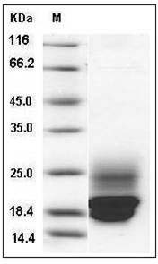 Rat Cystatin C / CST3 Protein (His Tag) SDS-PAGE