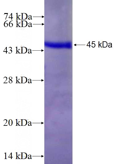 Recombinant Human PPP3CB SDS-PAGE