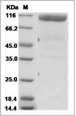 Human Gliomedin / GLDN Protein (Fc Tag)