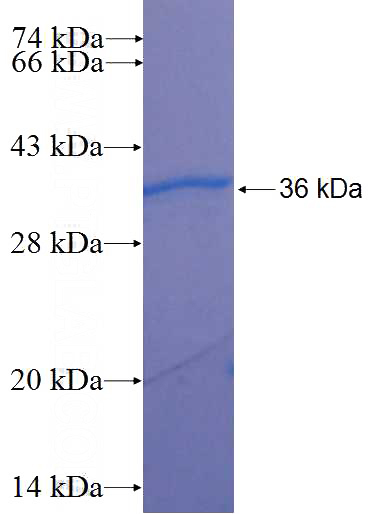 Recombinant Human FAM164B SDS-PAGE
