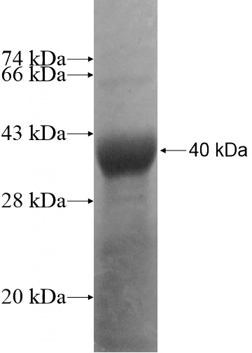 Recombinant Human CPNE7 SDS-PAGE