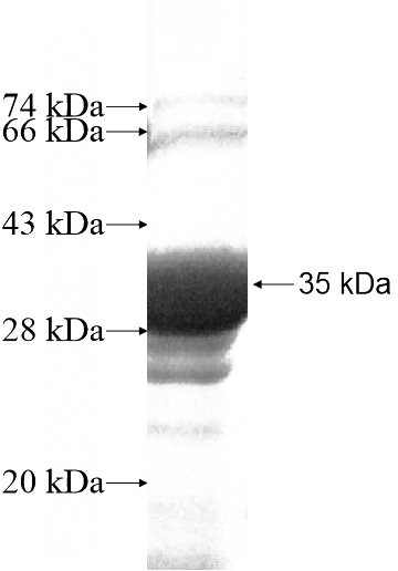 Recombinant Human CD1A SDS-PAGE