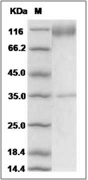 Rat CD34 Protein (Fc Tag) SDS-PAGE