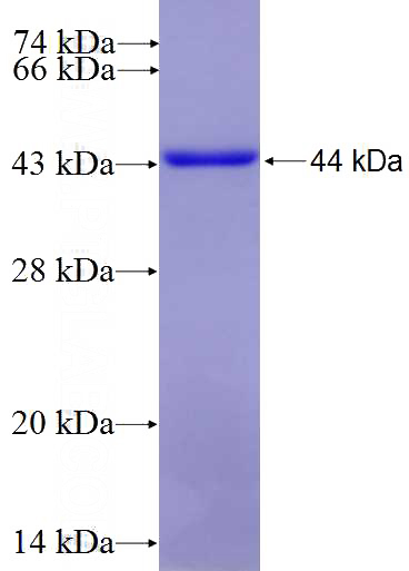 Recombinant Human COL5A1 SDS-PAGE