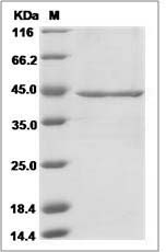 Human NEU2 / Sialidase-2 Protein (His Tag)