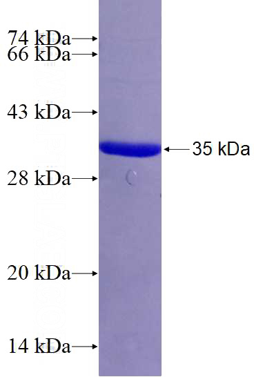 Recombinant Human ATP8A1 SDS-PAGE