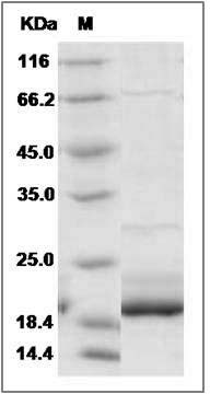 Human GCAP1 / GUCA1A Protein SDS-PAGE