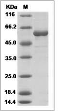 Influenza A H5N8 (A/turkey/Ireland/1378/1983) Hemagglutinin Protein (HA2 Subunit) (His Tag) SDS-PAGE