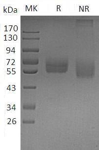 Human TYRO3/BYK/DTK/RSE/SKY/TIF (His tag) recombinant protein