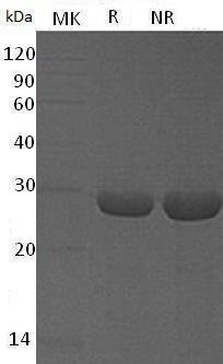 Human S100A13 recombinant protein