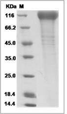 Cynomolgus Siglec-2 / CD22 Protein (His Tag)