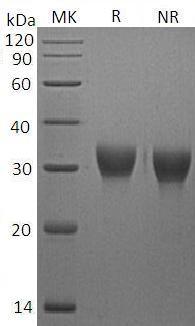 Mouse Vsig4 (His tag) recombinant protein
