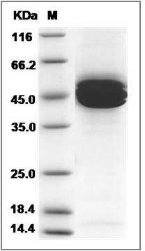 Mouse IL12B / IL-12B Protein (His Tag) SDS-PAGE