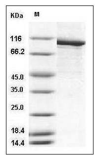 Mouse PARP-1 / PARP Protein (His Tag) SDS-PAGE