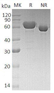 Human ALB/GIG20/GIG42/PRO0903 (His tag) recombinant protein