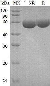 Human CPM (His tag) recombinant protein