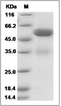 Human FAM3C / ILEI Protein (Fc Tag) SDS-PAGE