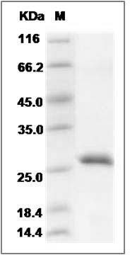 Mouse RPE / RPE2-1 Protein (His Tag) SDS-PAGE