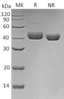 Human DCN/SLRR1B recombinant protein