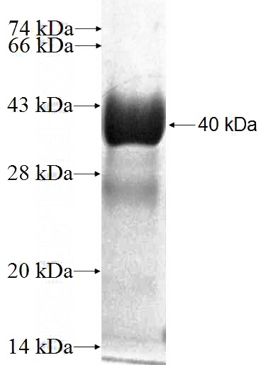 Recombinant Human SNX22 SDS-PAGE