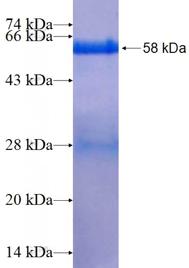 Recombinant Human PCDH24 SDS-PAGE