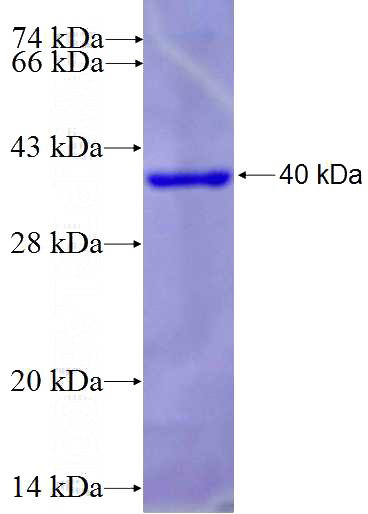 Recombinant Human SAA2 SDS-PAGE