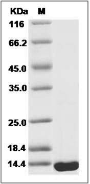 Human PFN4 / Profilin 4 Protein (His Tag) SDS-PAGE