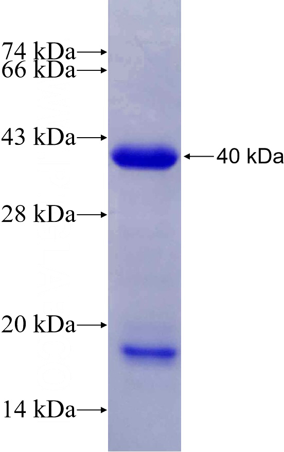 Recombinant Human C15orf55 SDS-PAGE