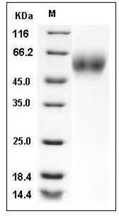 Mouse CD200R1 / OX-2R Protein (His Tag) SDS-PAGE