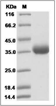 Canine IL22RA1 / IL22R Protein (His Tag) SDS-PAGE