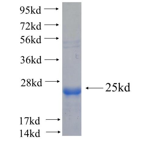Recombinant human NUDT3(Full length) SDS-PAGE