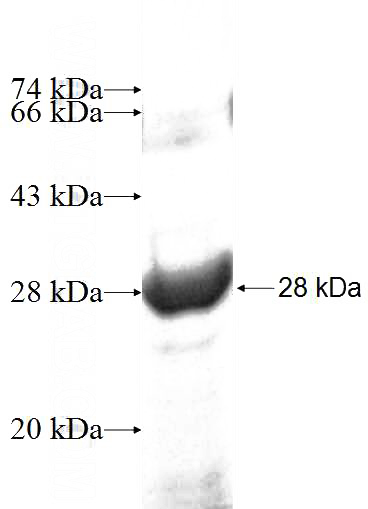 Recombinant Human SLC12A4 SDS-PAGE