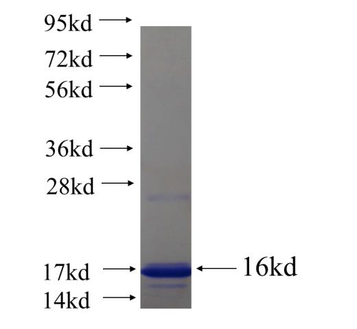 Recombinant human WDR20 SDS-PAGE