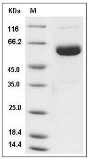 Human ULBP2 / N2DL-2 Protein (Fc Tag) SDS-PAGE