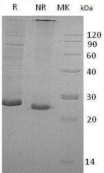 Human PRG3/MBPH/UNQ486/PRO1002 (His tag) recombinant protein