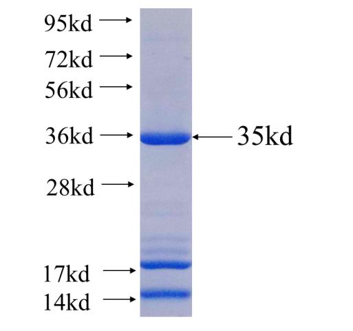Recombinant human PDCL2(Full length) SDS-PAGE