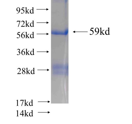 Recombinant human NR4A1 SDS-PAGE