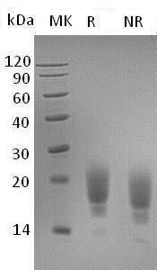 Mouse Tigit/Vstm3 (His tag) recombinant protein