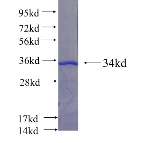 Recombinant human ZCCHC12 SDS-PAGE