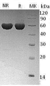Human ALDH1A2/RALDH2 (His tag) recombinant protein