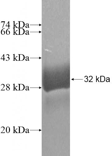 Recombinant Human S100G SDS-PAGE