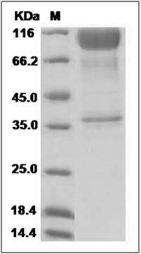 Rat IL23R / IL23 Receptor Protein (Fc Tag) SDS-PAGE