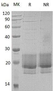Human/Mouse/Rat FNDC5/FRCP2 (His tag) recombinant protein