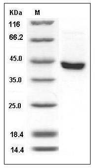 Mouse SerpinB8 Protein (His Tag) SDS-PAGE