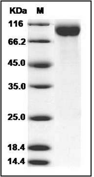 Human Siglec-2 / CD22 Protein (aa 176-687, His Tag) SDS-PAGE