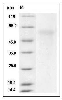 Mouse NGFR / P75 Protein (His Tag) SDS-PAGE