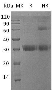 Human ADIPOQ/ACDC/ACRP30/APM1/GBP28 (His tag) recombinant protein