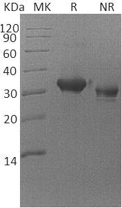 Human CXADR/CAR (His tag) recombinant protein